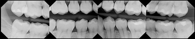 Dental work is stable with good career progression.